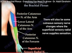 Image result for Brachial Plexus Posterior View