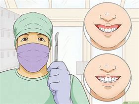 Image result for How to Smile Brightly