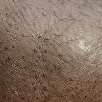 Image result for Hippo Skin Section Anatomy