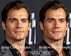 Image result for Dimples Near Chin