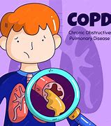 Image result for Best Treatment for COPD Illustration