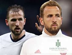 Image result for Harry Kane Teeth