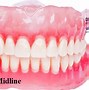 Image result for Midline Example