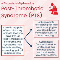 Image result for Post-Thrombotic Syndrome