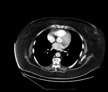 Image result for Abdomen CT Cor