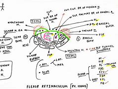 Image result for Flexor Retinaculum Wrist Bump