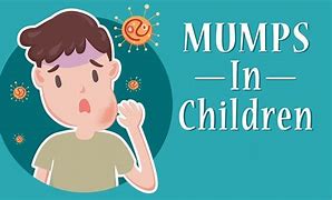 Image result for Mumps Child