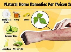 Image result for Poison Ivy Rash Cream