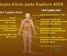 Image result for Gambar Gejala HIV