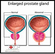 Image result for Prostate Gland Drawing