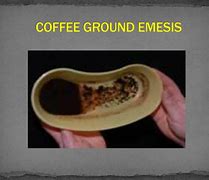 Image result for Coffee Ground Hematemesis