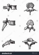 Image result for Dorsal Vertebrae