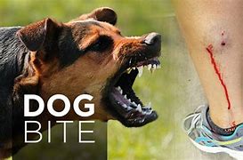 Image result for Dog Bite Injury Pics