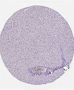 Image result for CD4 Liver