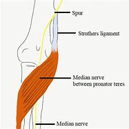 Image result for First Dorsal Interosseous Atrophy