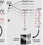 Image result for Continuous Wave Doppler Ultrasound