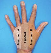 Image result for Dorsum of Left Hand