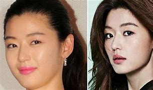 Image result for Jun Ji Hyun Plastic Surgery