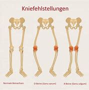 Image result for X Beine Kinder