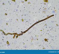 Image result for Fungal Hyphae in Soil