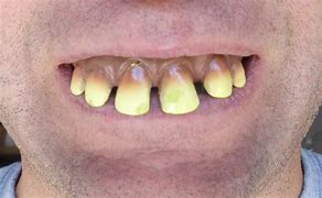 Image result for Big Teeth Smile Funny