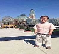 Image result for Gigantism Acromegaly and Dwarfism