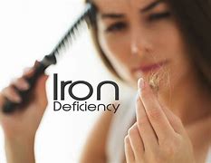 Image result for Iron Hair Loss