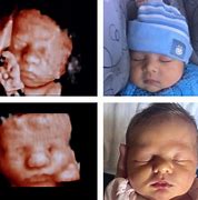 Image result for CT Baby Scan 3D