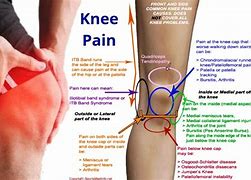 Image result for Left Knee