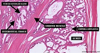 Image result for Prostate Gland Drawing