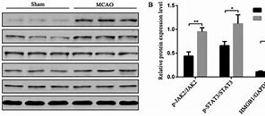 Image result for JAK2 STAT3