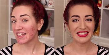 Image result for Facial Scar Makeup