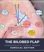 Image result for Bilobed Hand Flap