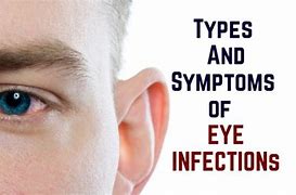 Image result for Symptoms of Eye Infection