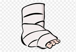 Image result for Ankle Fracture Clip Art