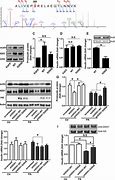 Image result for Hyperphosphorus Ddx