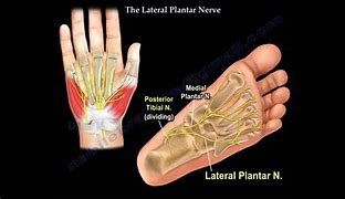 Image result for Lateral Plantar Vein