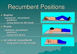 Image result for Dorsal Recumbent Position