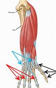 Image result for Thumb Extensor Tendonitis