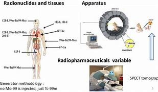 Image result for SPECT Camrra