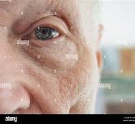 Image result for Poac Man Eyes