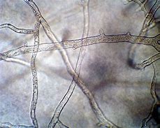 Image result for Fungi without Hyphae