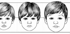 Image result for baby face proportions