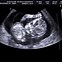 Image result for Baby Sonogram