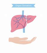 Image result for Liver Transplant Clip Art