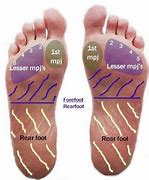 Image result for Plantar Arch of Foot