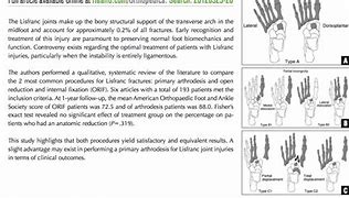 Image result for Lisfranc Orif