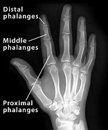 Image result for Fox Phalanges