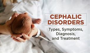 Image result for Cephalic Birth Defects