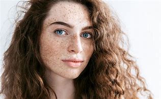 Image result for Ace Freckles